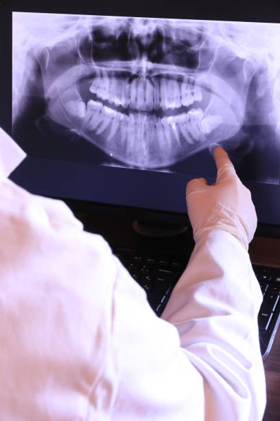 Best Emergency Wisdom Tooth Extraction in Newport, KY